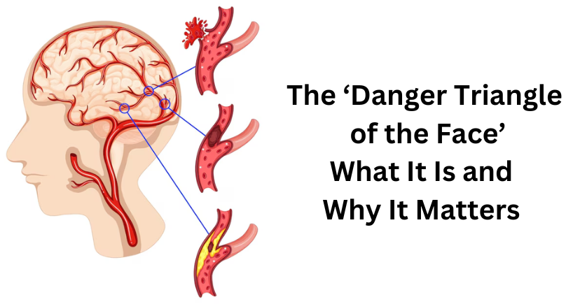 the-danger-triangle-of-the-face-what-it-is-and-why-it-matters